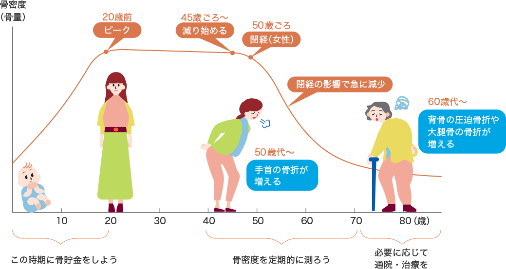 骨の健康｜骨と腸にはたらくオリゴ糖 マルトビオン酸NAVI